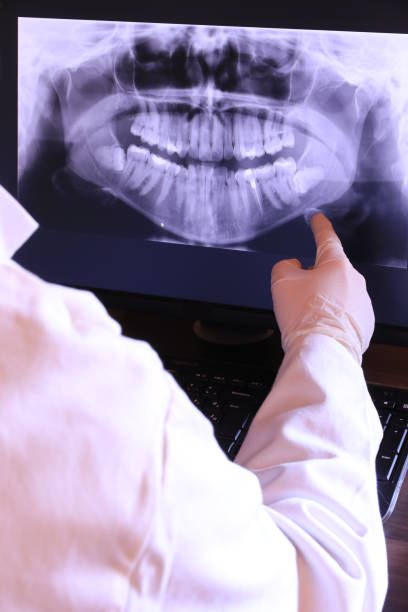 Best Emergency Tooth Extraction in Sissonville, WV
